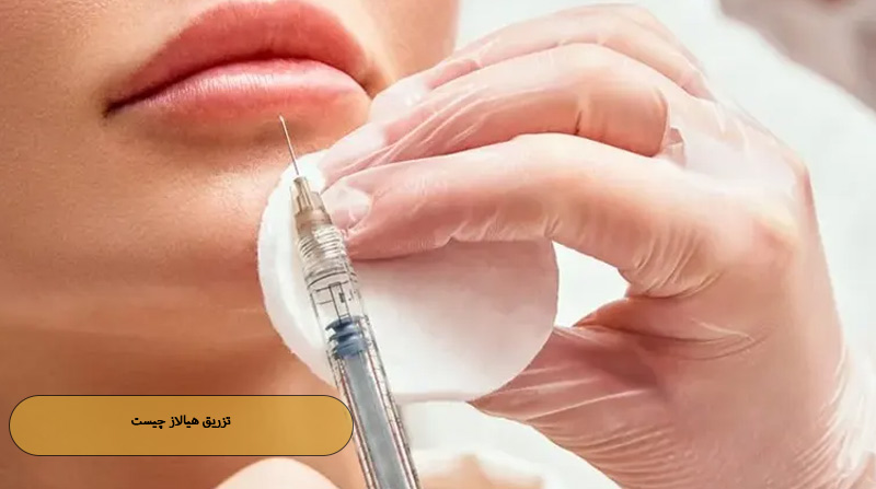 تزریق هیالاز چیست