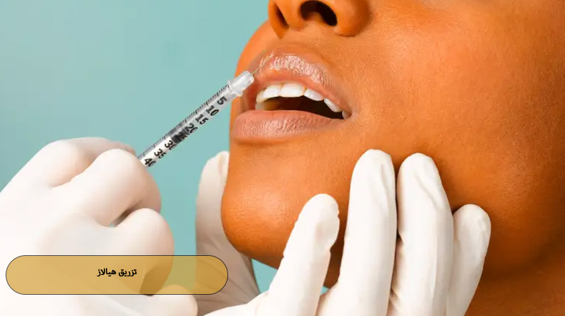 تزریق هیالاز