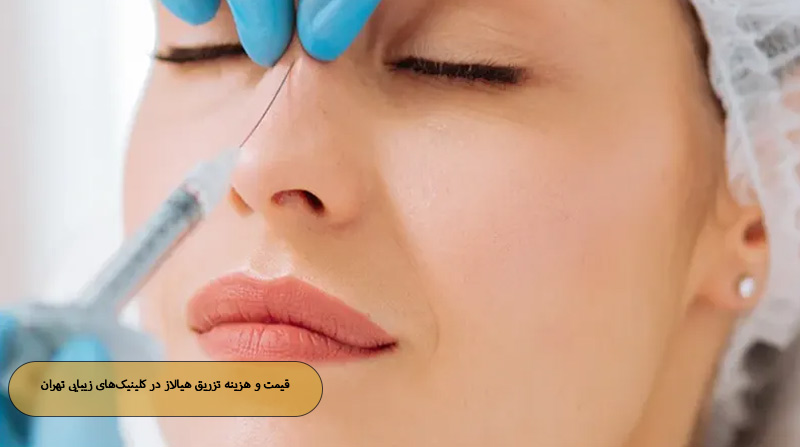 قیمت و هزینه تزریق هیالاز در کلینیک‌های زیبایی تهران