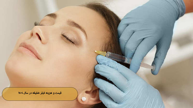 قیمت و هزینه فیلر شقیقه در سال ۱۴۰۴