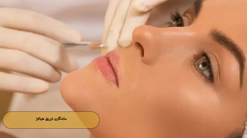 ماندگاری تزریق هیالاز