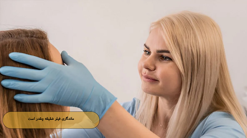 ماندگاری فیلر شقیقه چقدر است