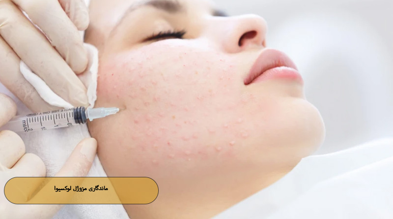 ماندگاری مزوژل لوکسیوا