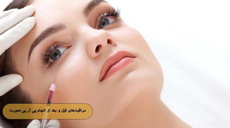 مراقبت‌های قبل و بعد از انجام پی آر پی صورت