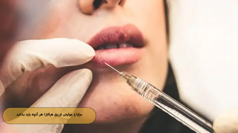 مزایا و عوارض تزریق هیالاز؛ هر آنچه باید بدانید