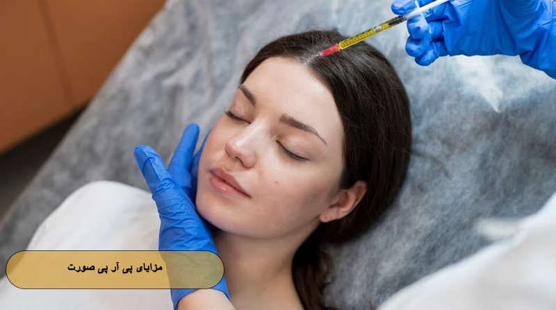 مزایای پی آر پی صورت