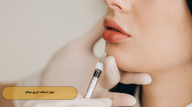 موارد استفاده تزریق هیالاز