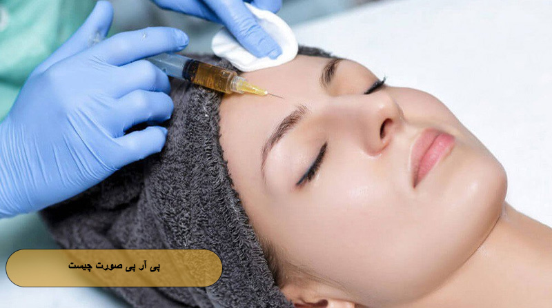 پی آر پی صورت چیست