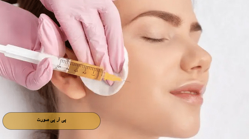 پی آر پی صورت