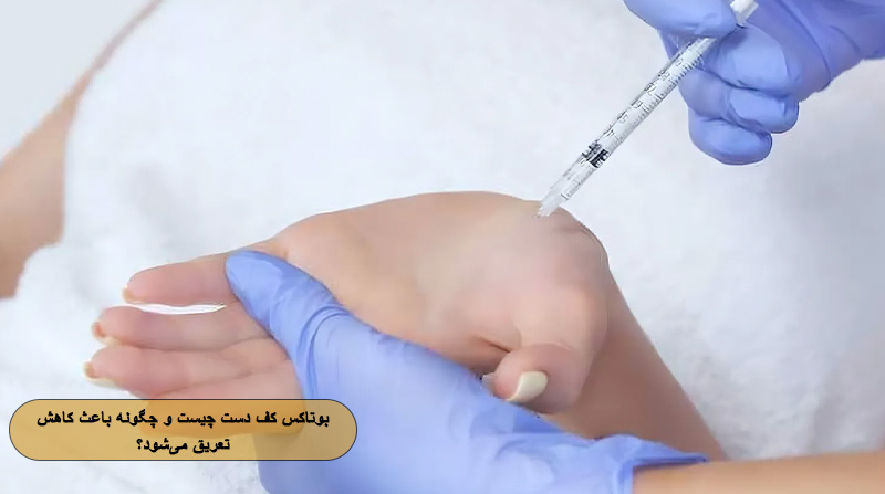 بوتاکس کف دست چیست و چگونه باعث کاهش تعریق می‌شود؟