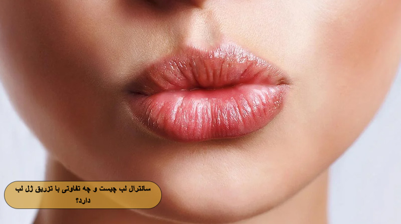 سانترال لب چیست و چه تفاوتی با تزریق ژل لب دارد؟