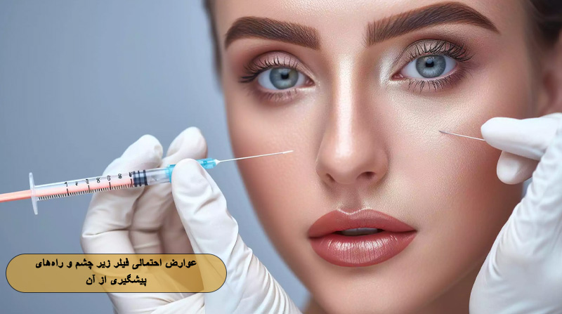 عوارض احتمالی فیلر زیر چشم و راه‌های پیشگیری از آن