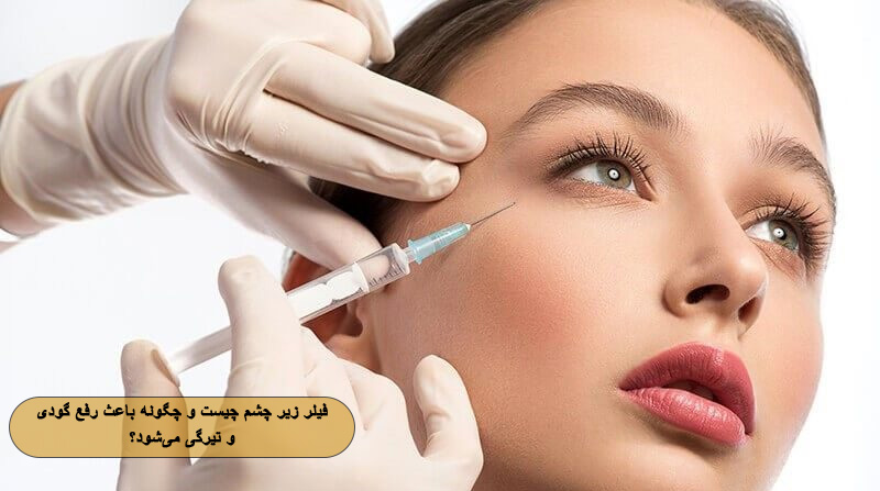 فیلر زیر چشم چیست و چگونه باعث رفع گودی و تیرگی می‌شود؟