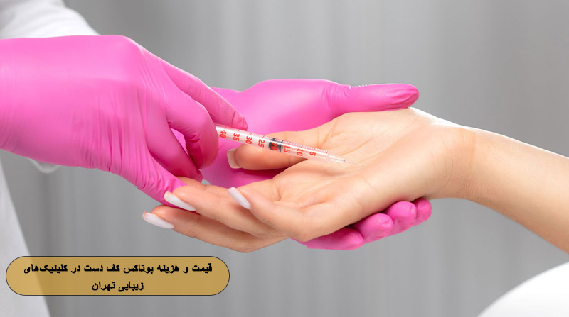 قیمت و هزینه بوتاکس کف دست در کلینیک‌های زیبایی تهران