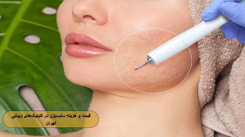 قیمت و هزینه سابسیژن در کلینیک‌های زیبایی تهران
