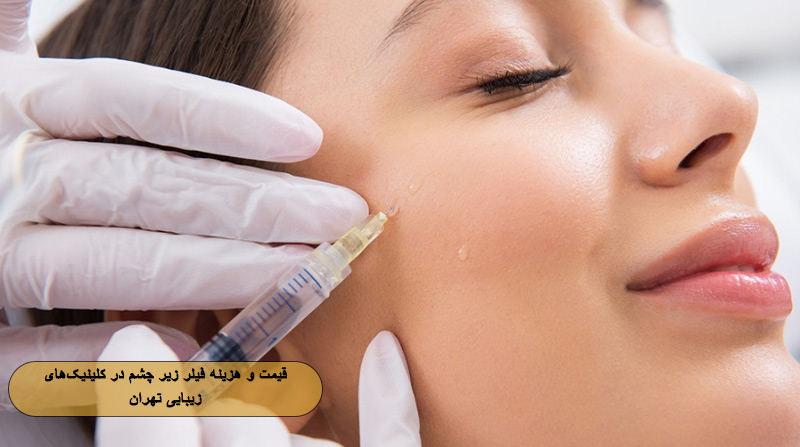 قیمت و هزینه فیلر زیر چشم در کلینیک‌های زیبایی تهران