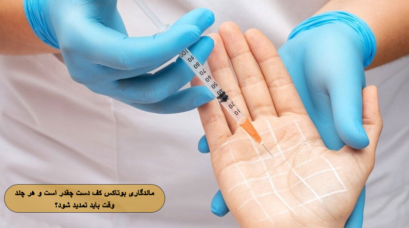 ماندگاری بوتاکس کف دست چقدر است و هر چند وقت باید تمدید شود؟