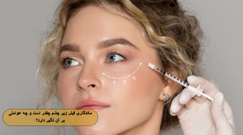 ماندگاری فیلر زیر چشم چقدر است و چه عواملی بر آن تأثیر دارد؟