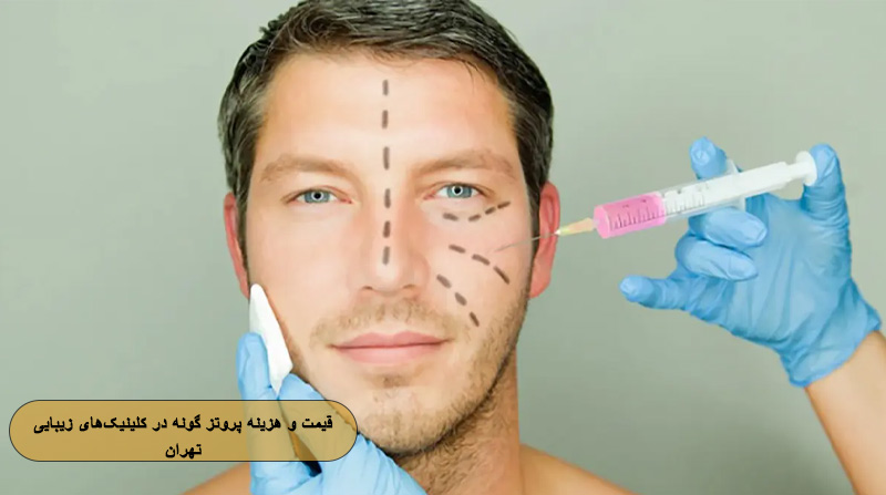 قیمت و هزینه پروتز گونه در کلینیک‌های زیبایی تهران