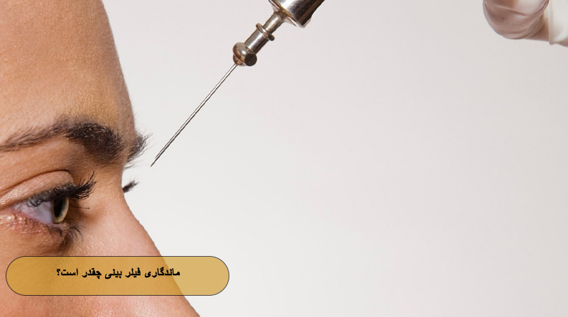 ماندگاری فیلر بینی چقدر است؟