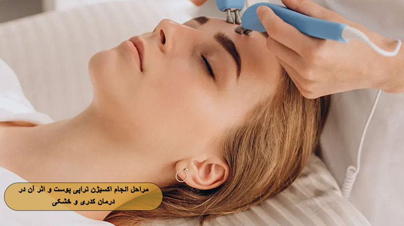 مراحل انجام اکسیژن تراپی پوست و اثر آن در درمان کدری و خشکی