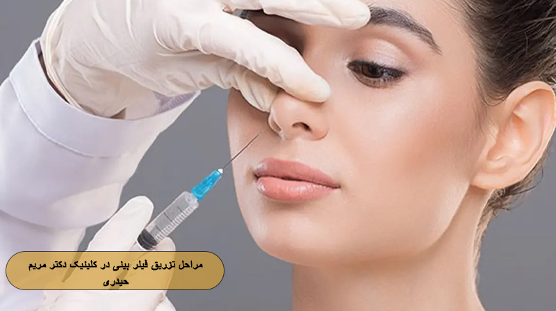مراحل تزریق فیلر بینی در کلینیک دکتر مریم حیدری