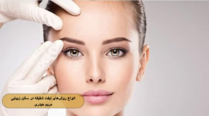 انواع روش‌های لیفت شقیقه در سالن زیبایی مریم حیدری