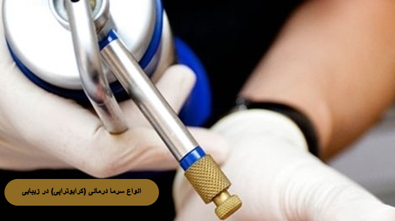 انواع سرما درمانی (کرایوتراپی) در زیبایی