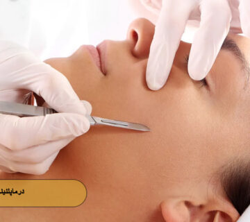 درماپلنینگ