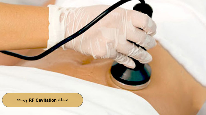 لاغری با دستگاه RF Cavitation چیست؟