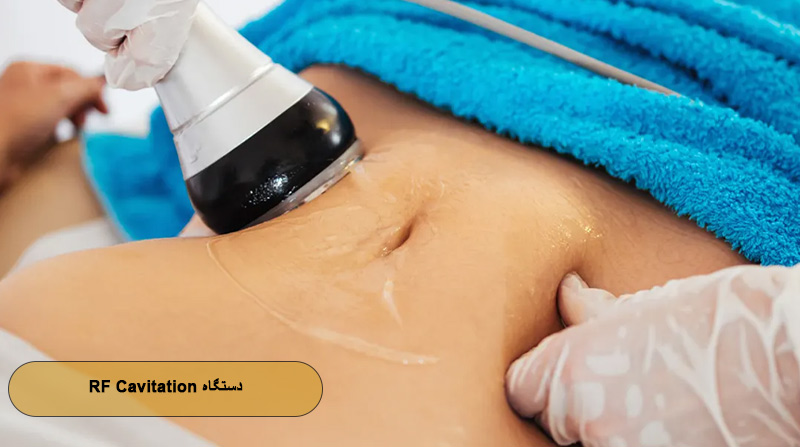 لاغری با دستگاه RF Cavitation
