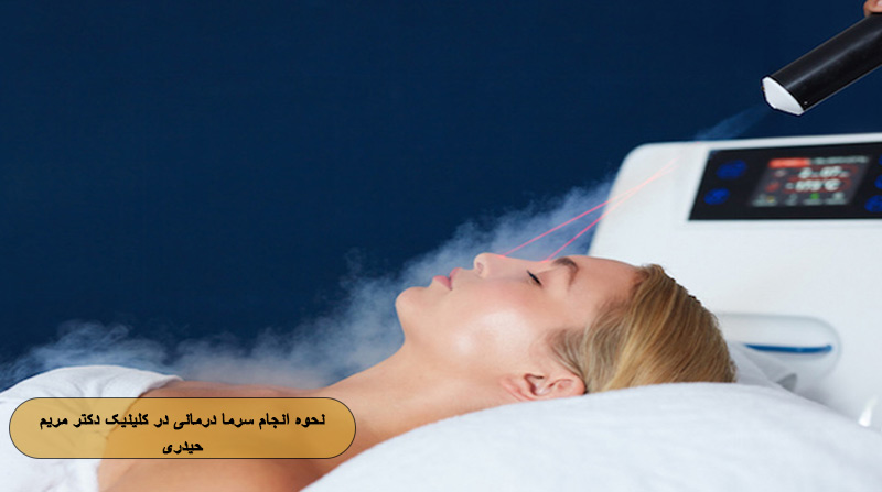 نحوه انجام سرما درمانی در کلینیک دکتر مریم حیدری