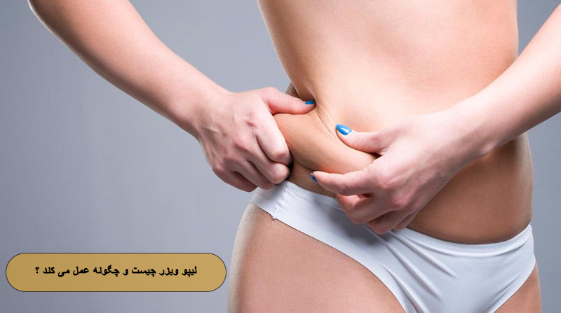 لیپو ویزر چیست و چگونه عمل می ‌کند ؟