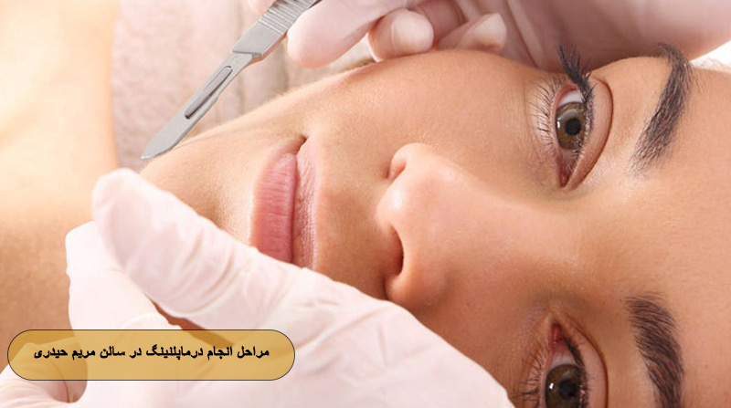 مراحل انجام درماپلنینگ در سالن مریم حیدری