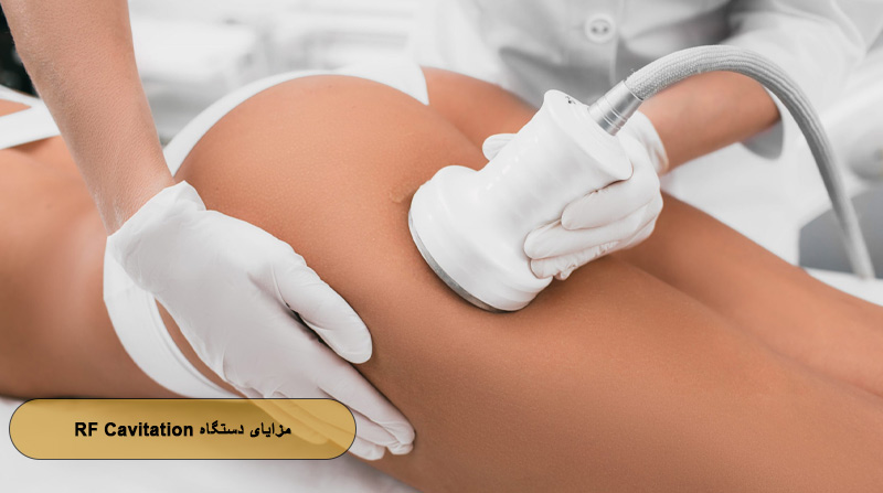 مزایای لاغری با دستگاه  RF Cavitation