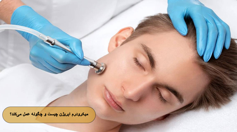 میکرودرم ابریژن چیست