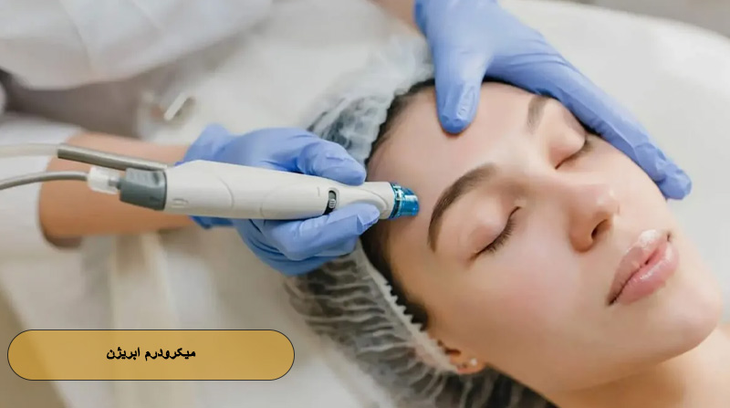 میکرودرم ابریژن