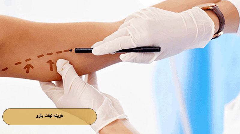 هزینه لیفت بازو