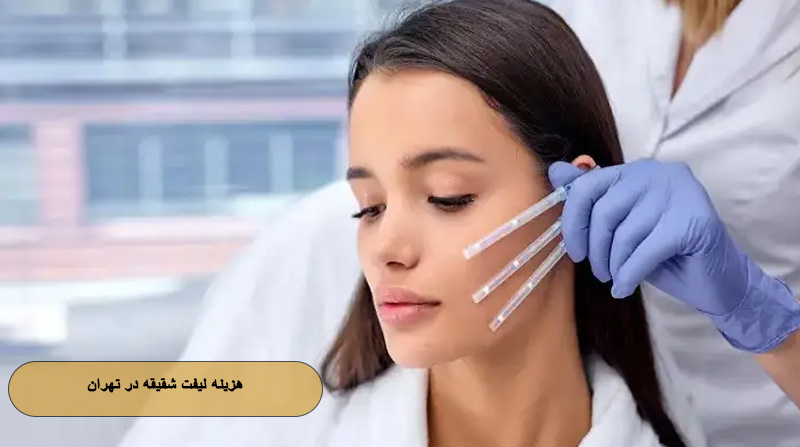 هزینه لیفت شقیقه در تهران