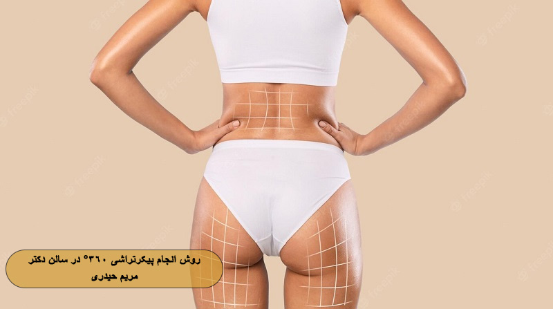 روش انجام پیکرتراشی ۳۶۰ درجه در سالن دکتر مریم حیدری