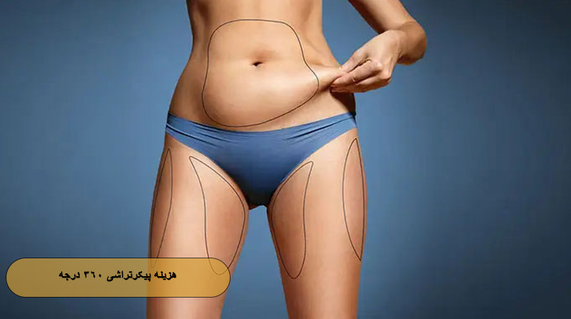 هزینه پیکرتراشی ۳۶۰ درجه