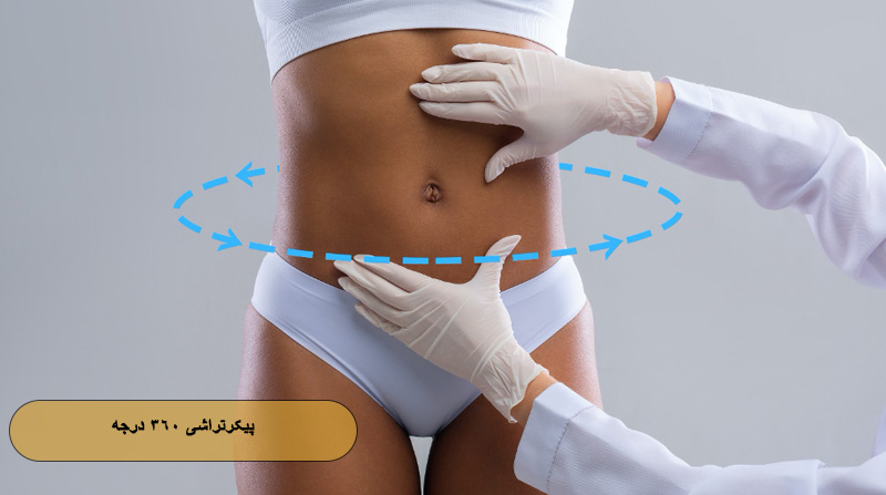 پیکرتراشی ۳۶۰ درجه چیست ؟