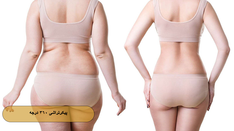 پیکرتراشی ۳۶۰ درجه