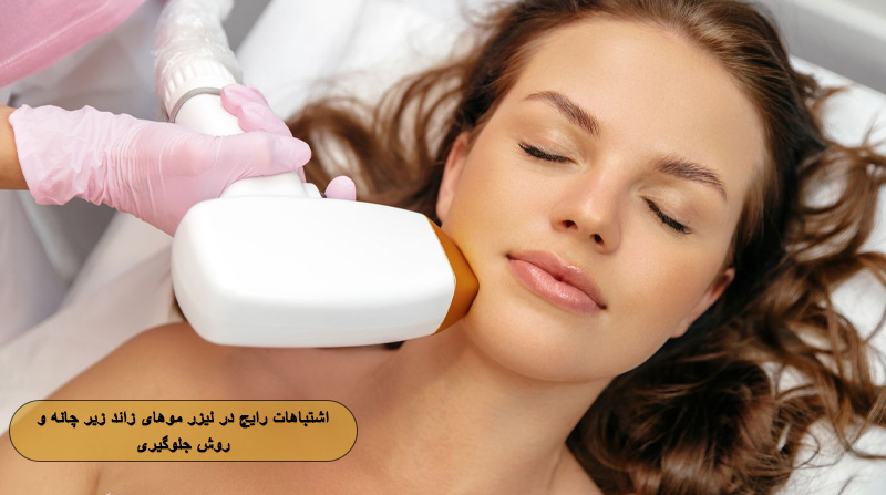 اشتباهات رایج در لیزر زیر چانه و روش جلوگیری