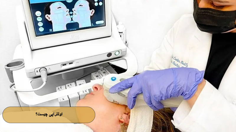 اولتراپی چیست؟