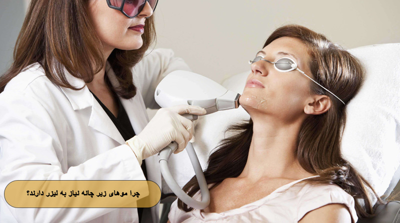 چرا لیزر زیر چانه اهمیت دارد؟