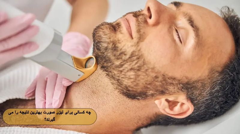 چه کسانی برای لیزر موهای زائد صورت بهترین نتیجه را می‌گیرند؟